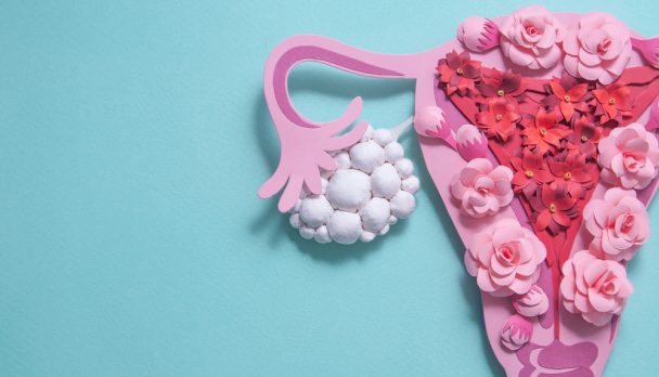 Concept,Polycystic,Ovary,Syndrome,,Pcos,Awareness.,Women,Reproductive,System.,Paper