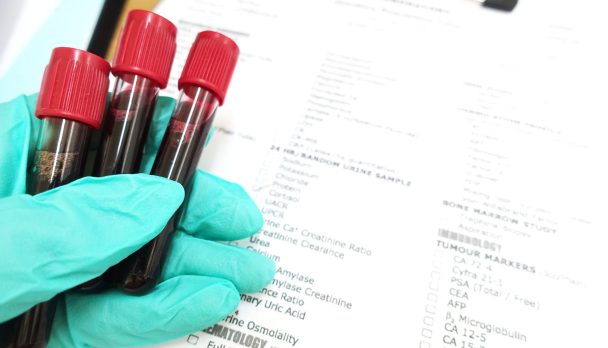 Blood,Sampling,In,Laboratory,In,Laboratory